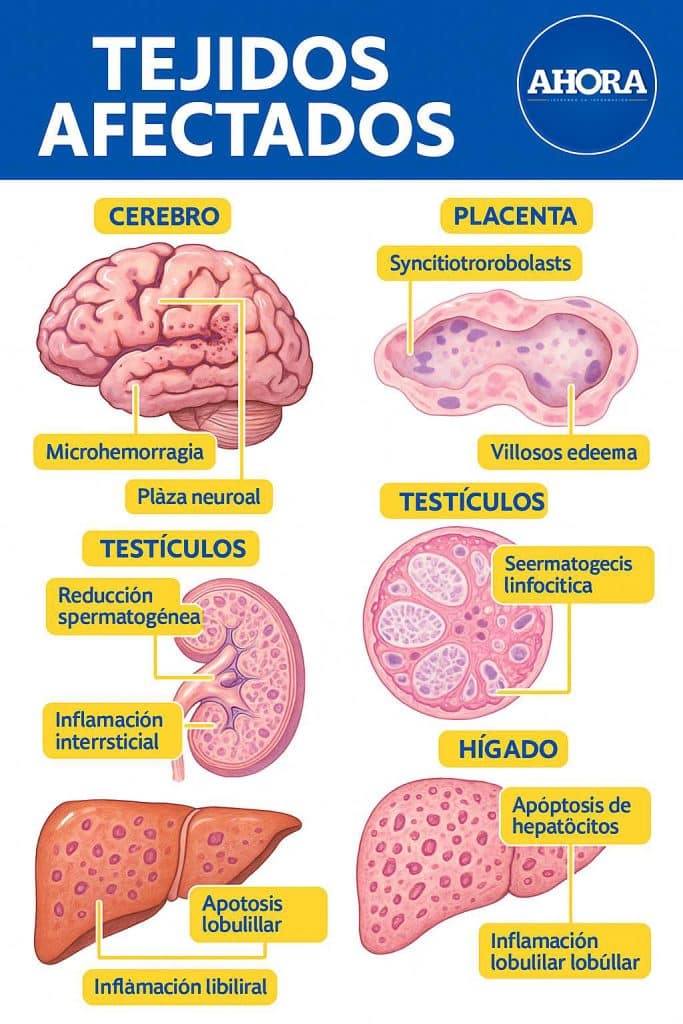 La agricultura intensiva con riego, la urbanización, el comercio de alimentos procesados y la globalización logística uniformizan el riesgo, más allá de los niveles de renta
